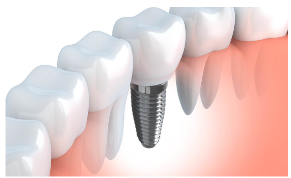 患者様の負担にならない治療を致します