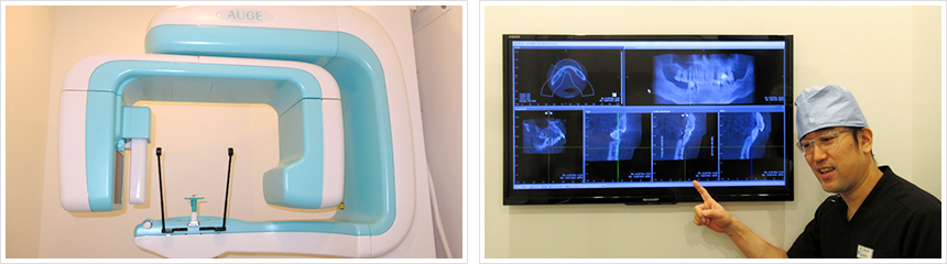 親知らずの抜歯や根管治療病変の確認などにおいて、高い診断精度が求められる場面で大きな力を発揮します