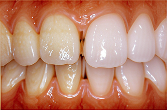丁寧なカウンセリングと最小限の処置で自然な歯を守る診療を実践