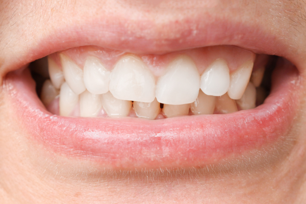 ※画像はイメージです