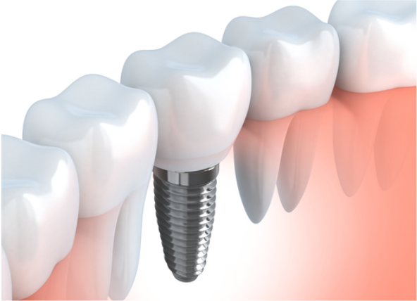 見た目も噛み心地も、自然な仕上がりを目指します