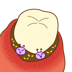 歯茎のトラブルも安心！プロのサポート