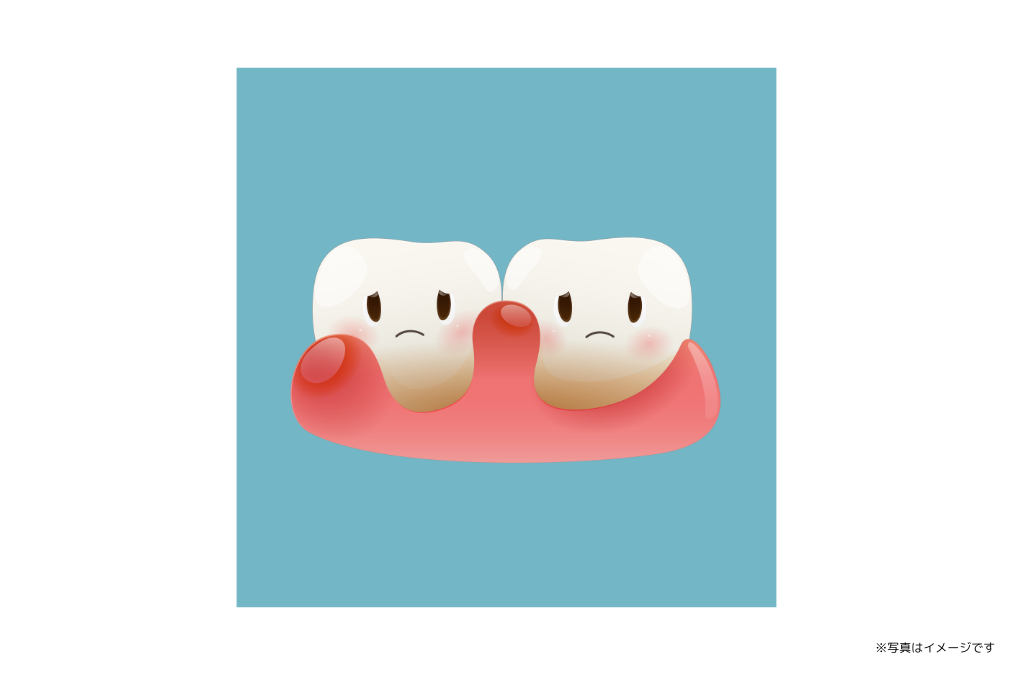 定期的な検診で歯周組織の健康を守ります