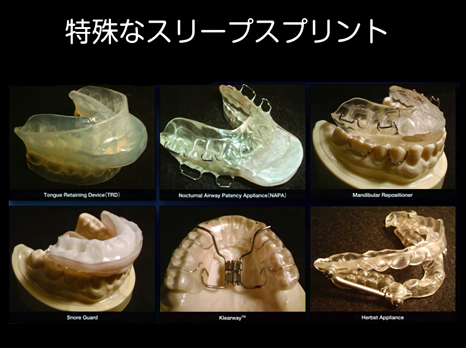 スリープスプリントによる治療