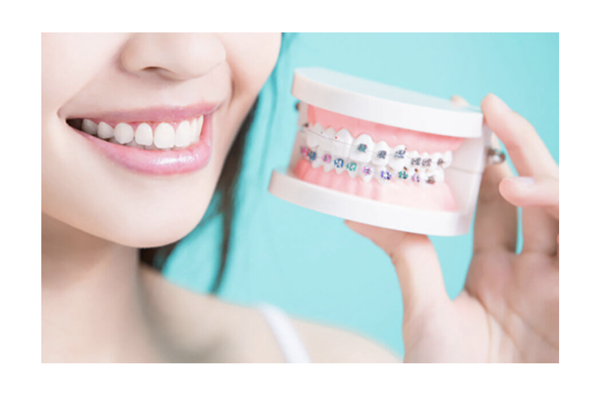 髙松歯科医院では、噛みあわせに関する診療を行っています