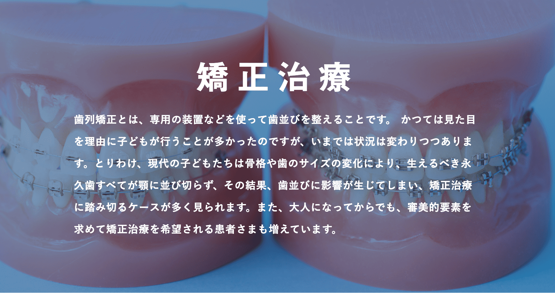 歯並びや噛み合わせを整えることで、機能面と審美面の両方を改善する治療です