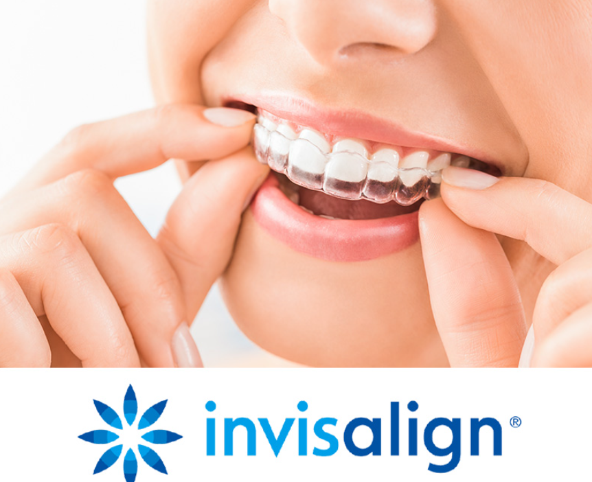 金属を使用しないため、口内の粘膜が傷つくこともありません。