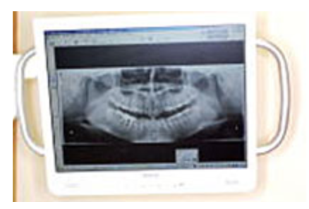 液晶モニターにて、患者様へ丁寧にご説明いたします