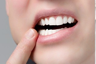 早期の段階で受診することが重要です
