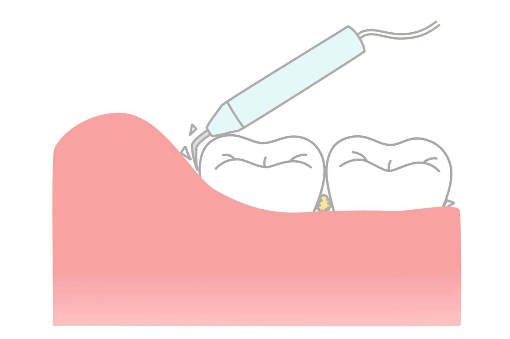 患者様にリスクや治療内容を分かりやすく説明し、一緒に治療と予防に取り組める体制を整えています
