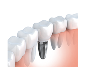 長期的に快適な使用をサポートしています