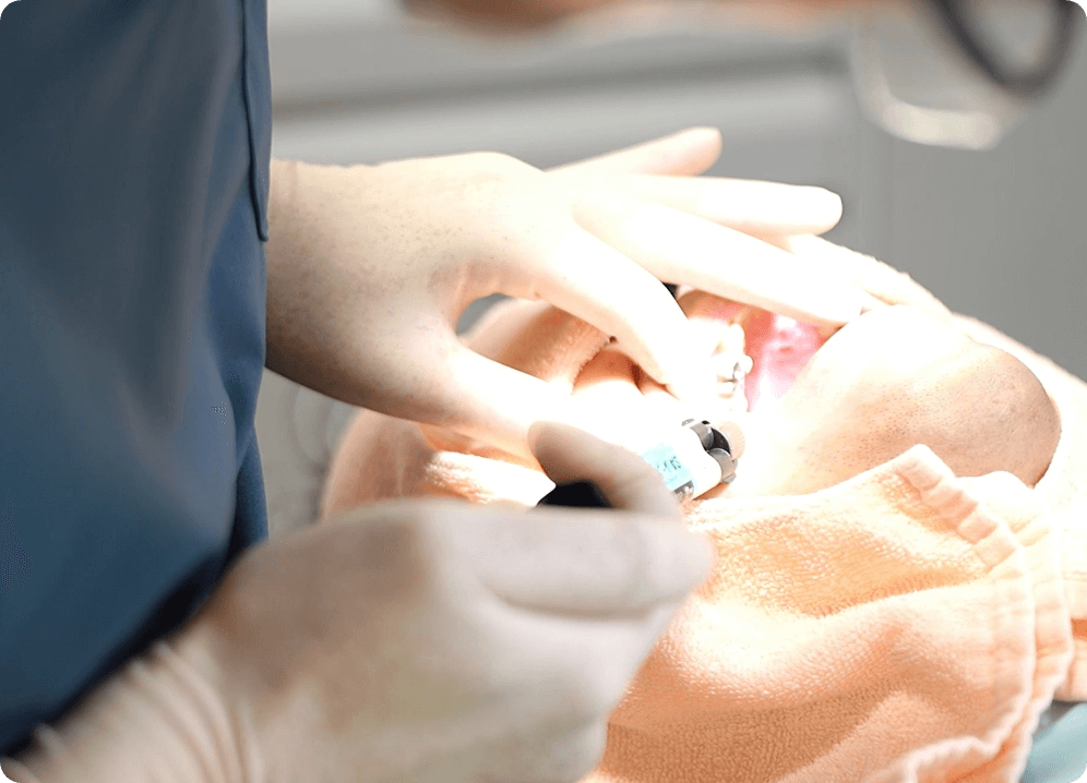 一般歯科においてむし歯や歯周病、入れ歯の作成など、幅広い治療に対応しています