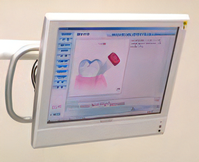 診療ユニットに設置したモニター