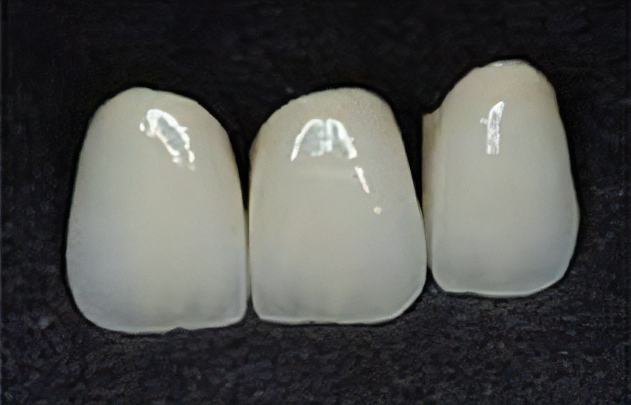 患者様一人一人に最適な審美治療を提案し、美しい笑顔と健康を提供しています。