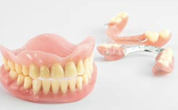 時間をかけて患者様の理想を求める入れ歯（義歯）製作