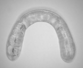 スタビライゼーションスプリント