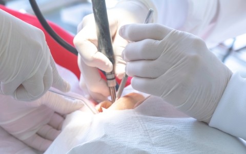 親知らずが気になる方へ