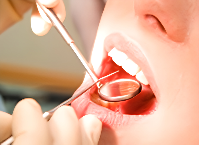 進行を防ぐ歯周病ケアの重要性