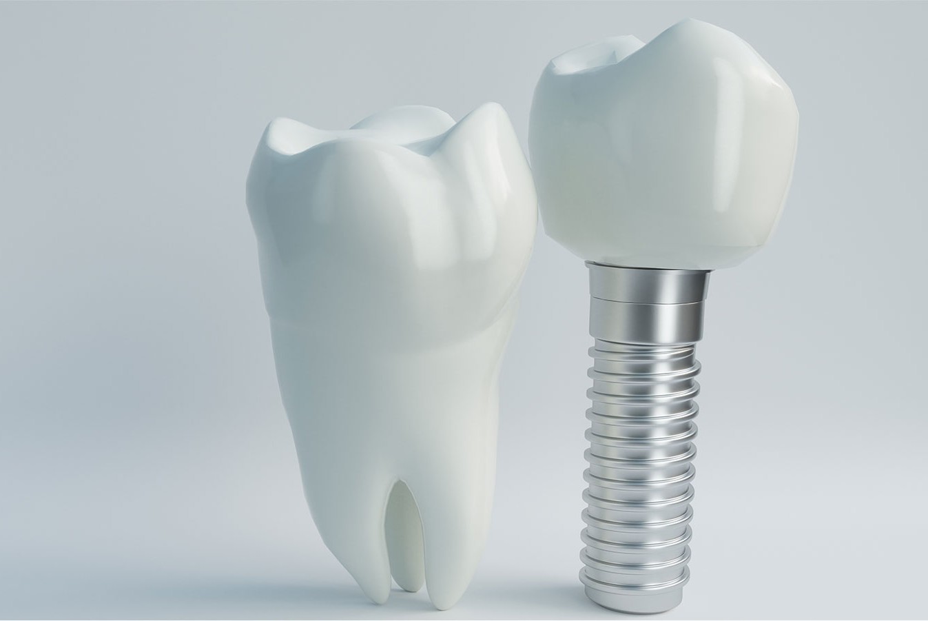歯を失った部分を補う選択肢のひとつとしてインプラント治療を提供しています
