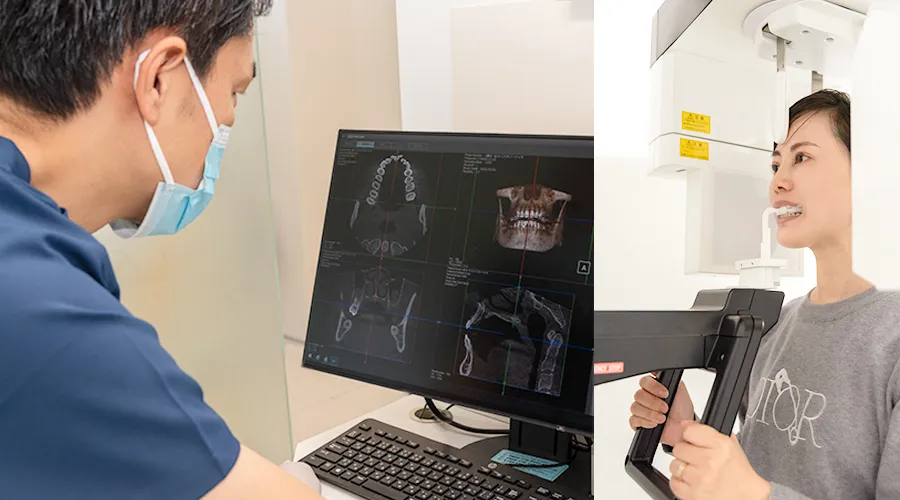 親知らずの抜歯や外傷の処置、顎関節症のケアなど、口腔外科に関するさまざまな治療に対応しています