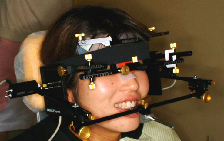 咬み合わせの改善で機能性や見た目も改善できます