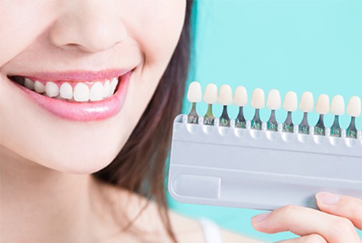 自然な白さで、美しい笑顔に