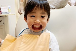 痛みがない段階でお子様としっかり話し合い、スムーズに治療を進めることがアスキーデンタルクリニックの基本方針です