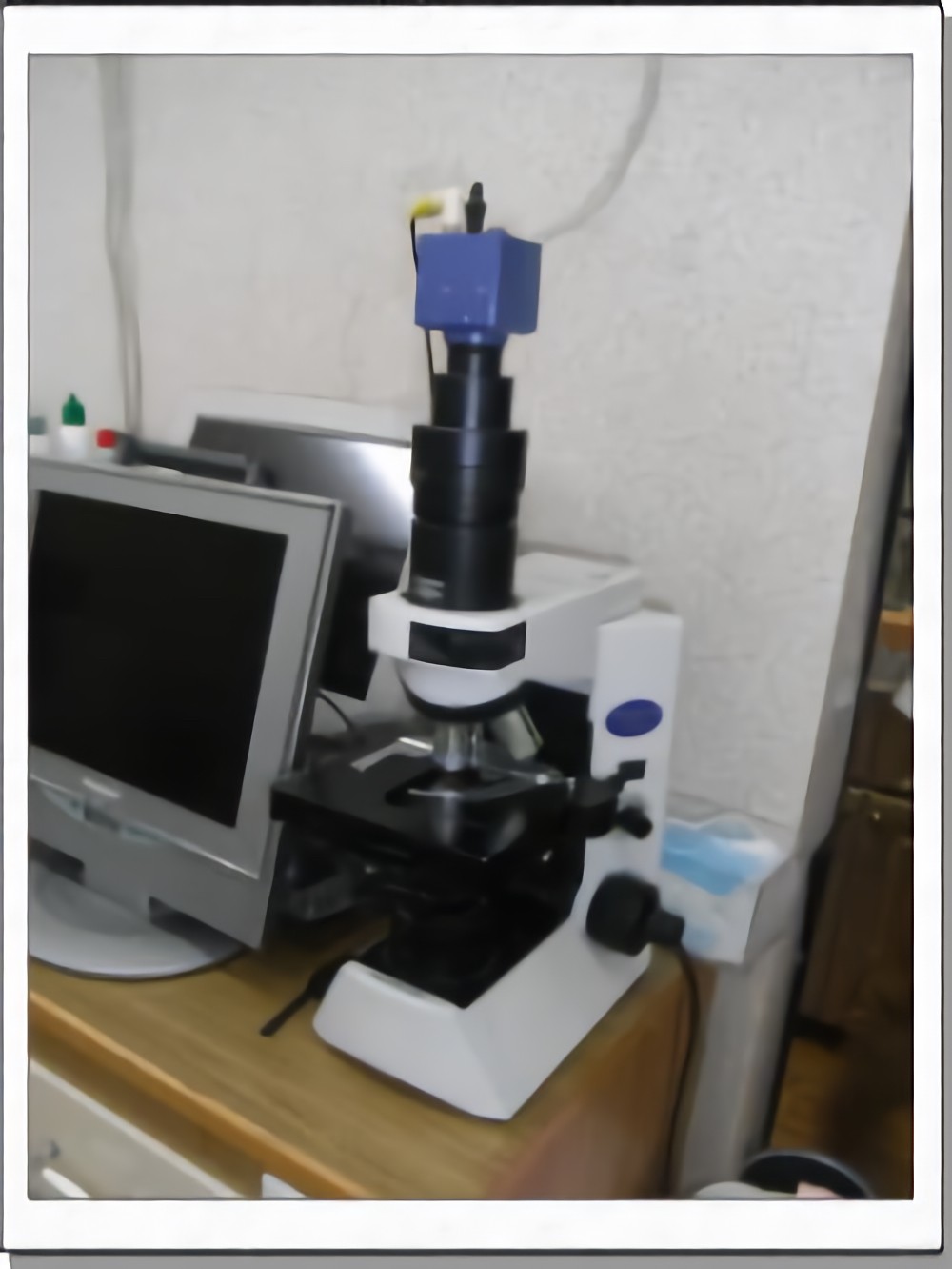 顕微鏡で歯周病の状態を詳しく検査