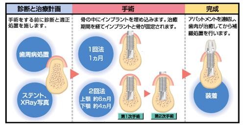 口腔インプラント専門医です