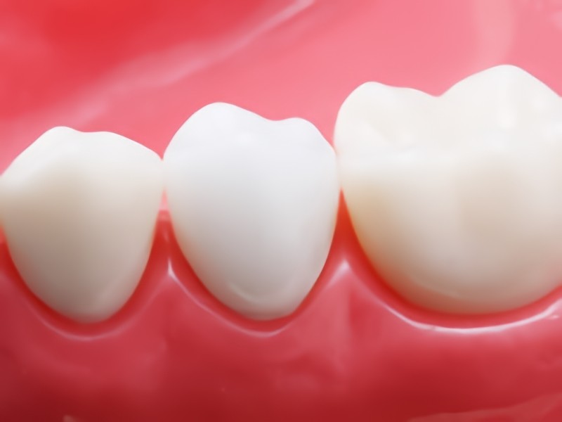 最適な材料での治療をご提案します