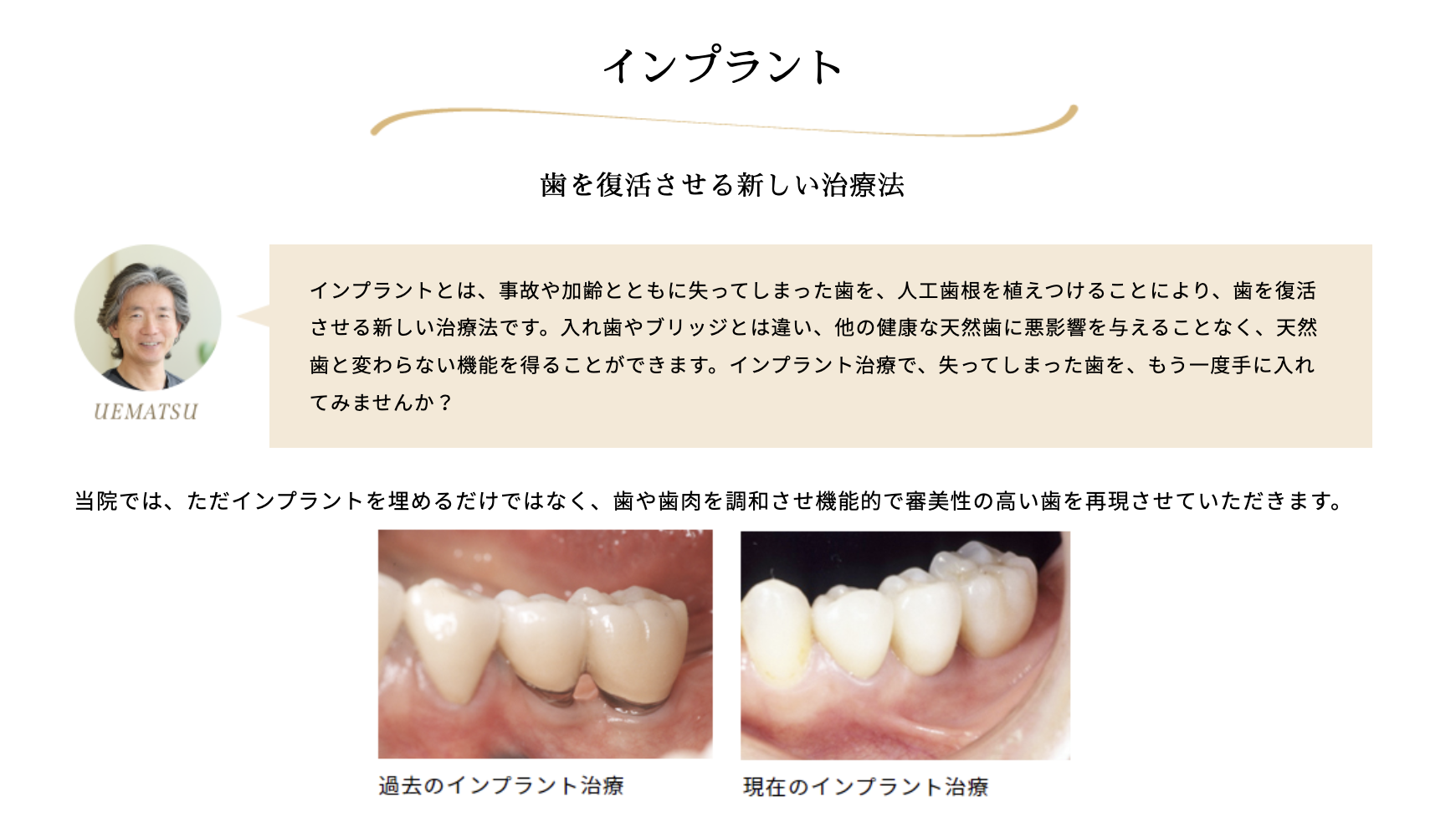 日本口腔インプラント学会専門医・指導医が在籍し、安全で精密な治療を提供しています