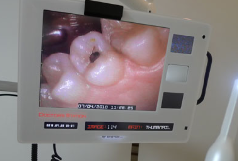 写真などを使い、治療内容をわかりやすく説明します