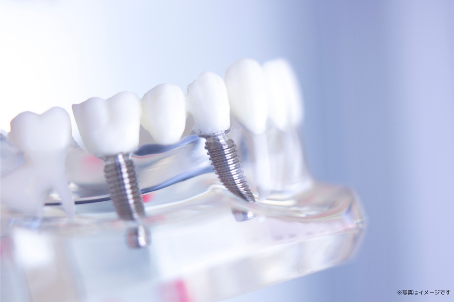 インプラント治療を通じて失った歯を回復することに力を入れています