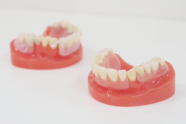 スマイルデンチャーと呼ばれています