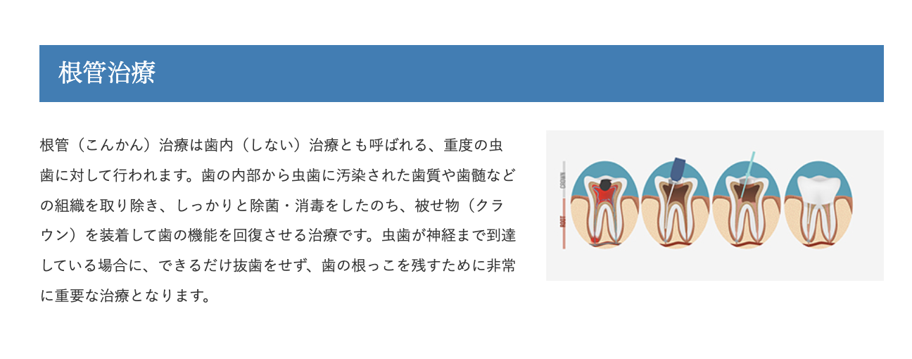 根管治療は、重度の虫歯に対し歯を可能な限り保存するために行われる重要な治療です