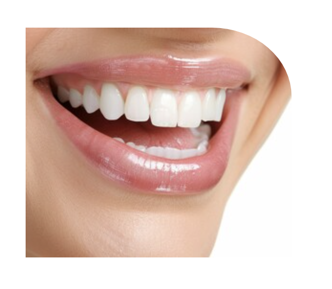 審美歯科では、歯の機能性だけでなく美しさにも焦点を当てた治療を提供しています