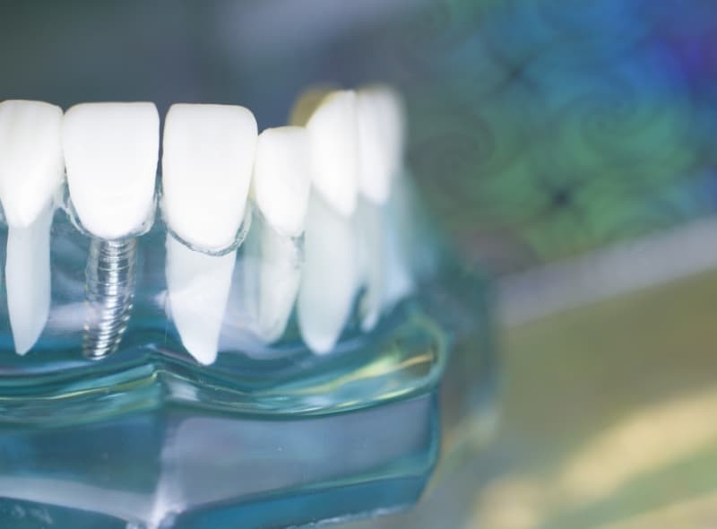 継続的な検診と専門的なクリーニングを通じて、トラブルの予防と良好な状態の維持をサポートしています。