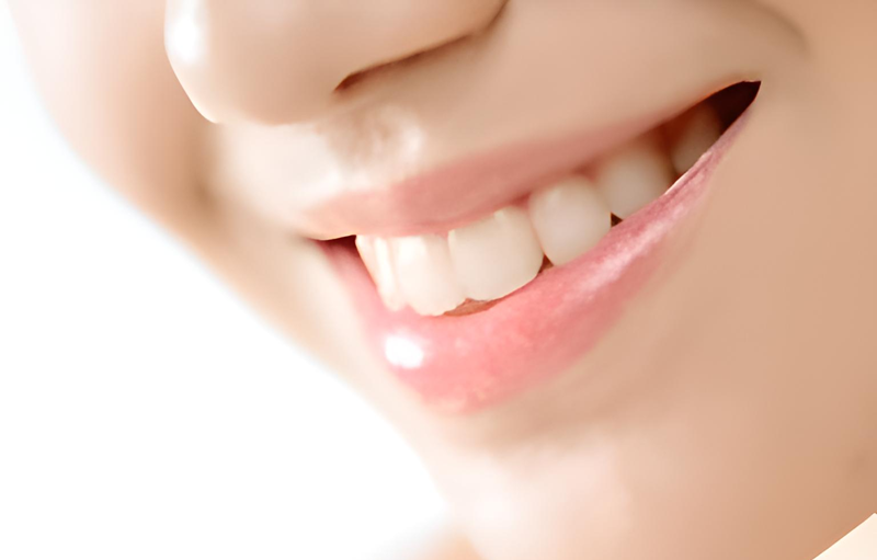 ポリリンプラチナ技術を活用した低刺激で効果的なホワイトニング