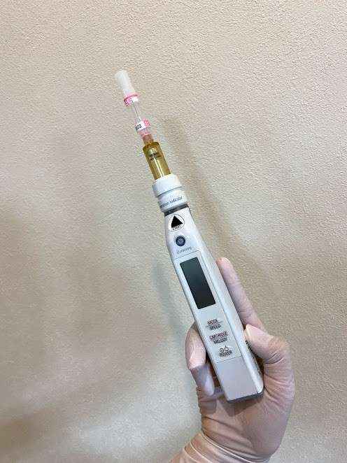 注入スピードを一定に保つことで痛みを和らげることができる電動麻酔器