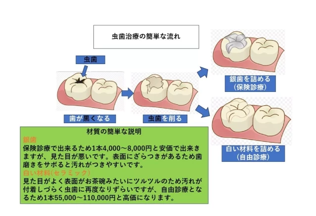 歯の痛みや違和感を感じた際には、早めにご相談いただくことをお勧めします。