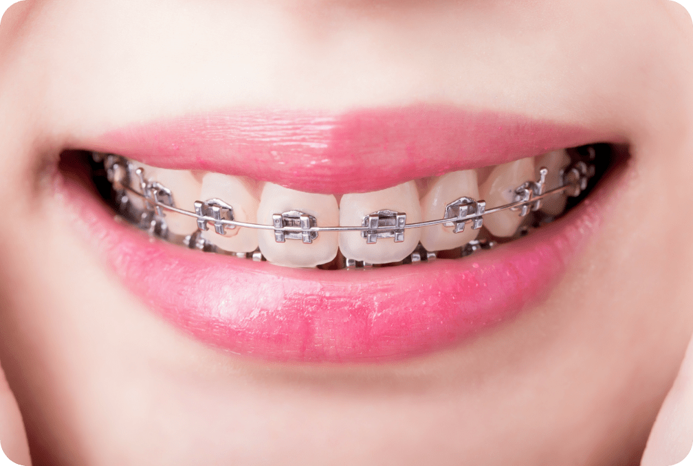 矯正歯科治療を提供