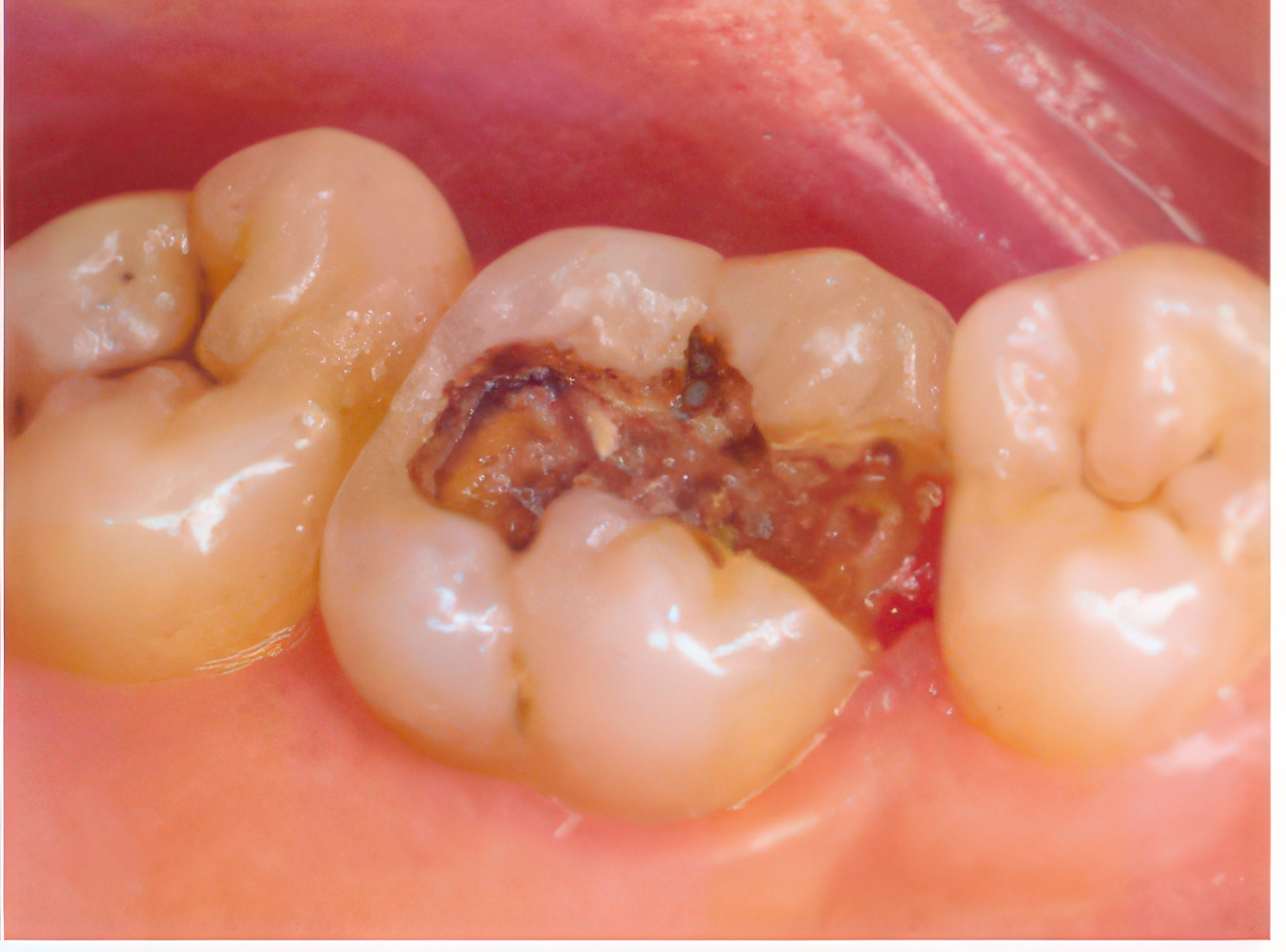 機能性や審美性も考慮します