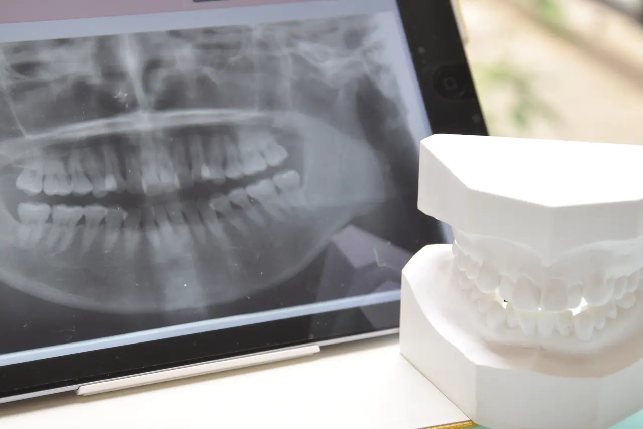 【東海市荒尾町土日診療OK】予防歯科とインプラント治療のあらおデンタルクリニック