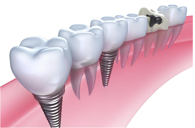 患者様一人ひとりの状態に合わせた治療計画を立てています