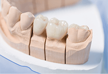 患者様一人一人のニーズに応じたさまざまな義歯の選択肢を提供しています