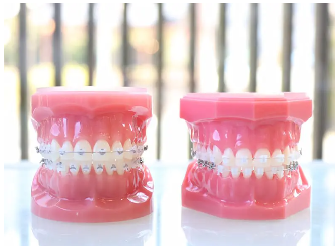 矯正専門医が月2回診療を行い、患者様一人ひとりの歯並びや噛み合わせのお悩みに対応しています