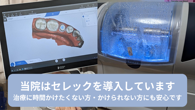 最短１日で治療が完了できます