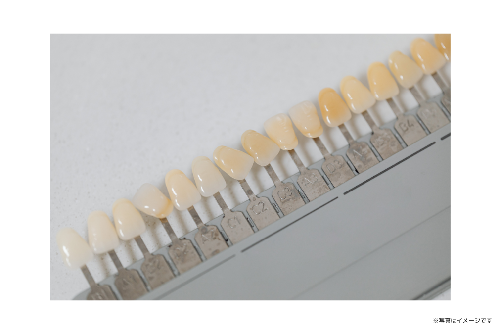 歯の着色汚れを削らずに薬剤で白くしています