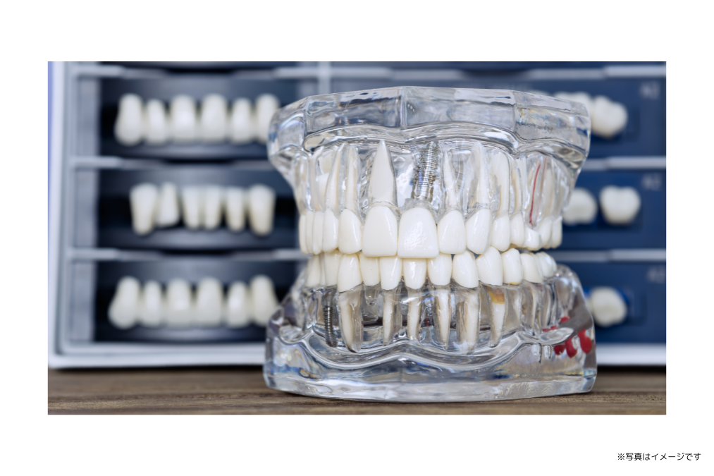 ※写真はイメージです