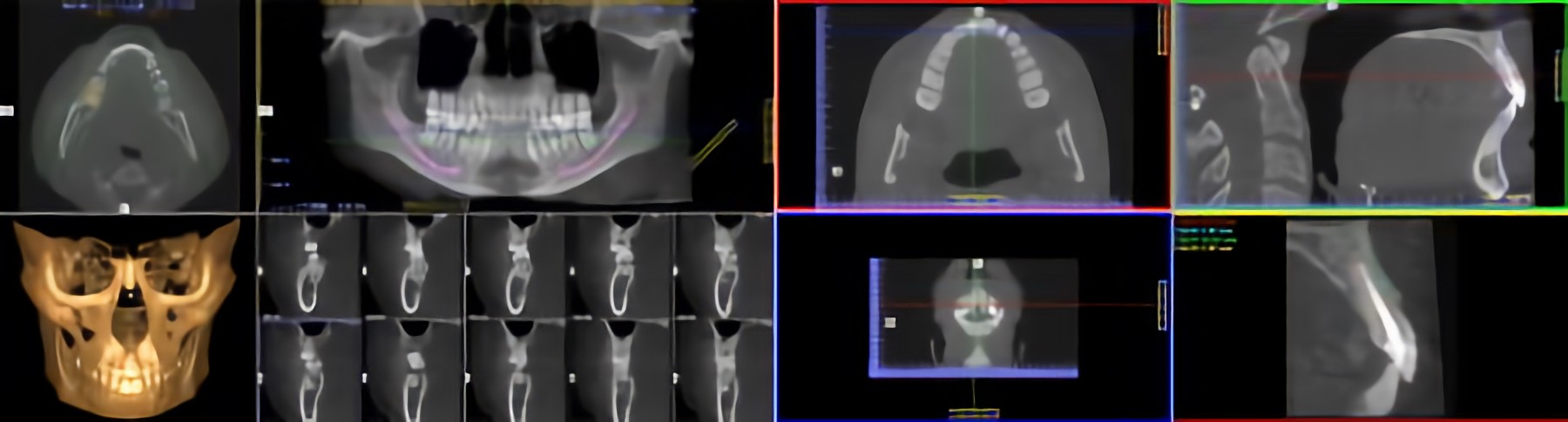 CTによる精密な診断と豊富な実績